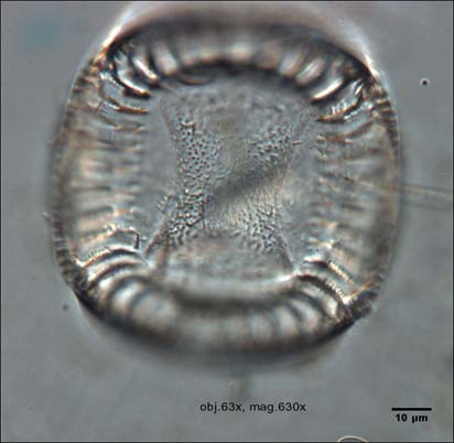 Campylodiscus limbatus    