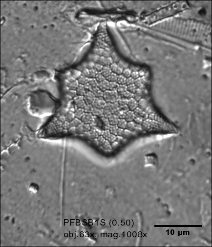 Triceratium dubium    